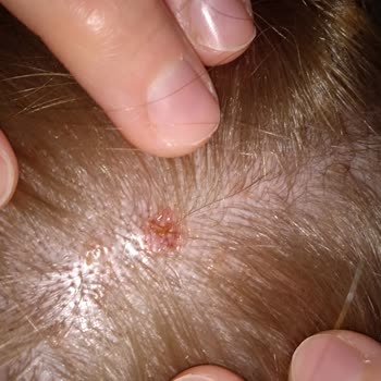 Menekşe Bay & Bayan Kuaför Vücudumda Ciddi Yaralar Oluşturma