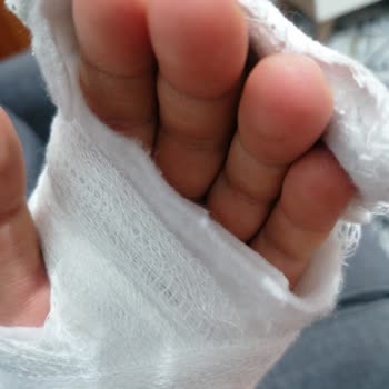 Çumra Devlet Hastanesi Pansuman Ve Alçı Sorunu