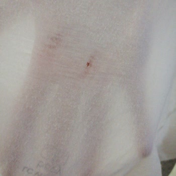 Profilo CGA142ZXTR Çamaşır Makinesi Tişörtleri Yırttı