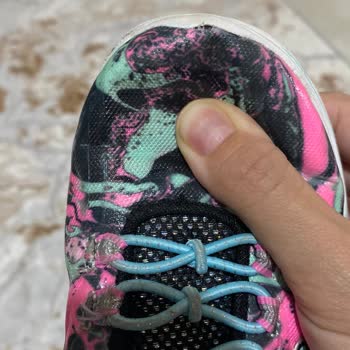 Skechers Ayakkabı Deformasyonu