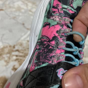Skechers Ayakkabı Deformasyonu