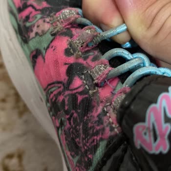 Skechers Ayakkabı Deformasyonu