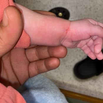 Mmt Amerikan Hastaneleri İlgisiz Personel