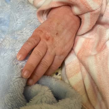 Mmt Amerikan Hastaneleri İlgisiz Personel