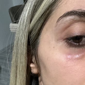 Kosmetolog _lalita Mağduriyet Yaşama