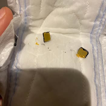 Molped Supernight Ekonomik Pedinde Sağlık Sorunu