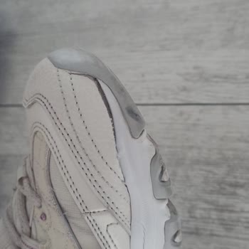 Skechers Ayakkabıda Açılma / Tüketici Hatası Dendi!