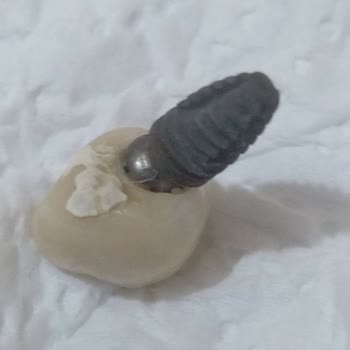 Özel Bağcılar Ağız ve Diş Sağlığı Polikliniği Bir Buçuk Ayda Ağrıyan Ve Sallanan İmplant Modeli