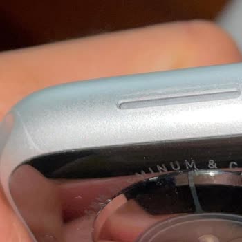 Spigen Apple Watch Kılıfı, Saatimi Derin Çizdi