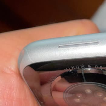 Spigen Apple Watch Kılıfı, Saatimi Derin Çizdi