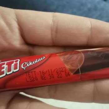 Eti Gıda Ürün Bozuk Çıktı