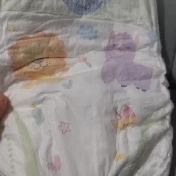 Molfix Bezde Sarı Çizgi Yok