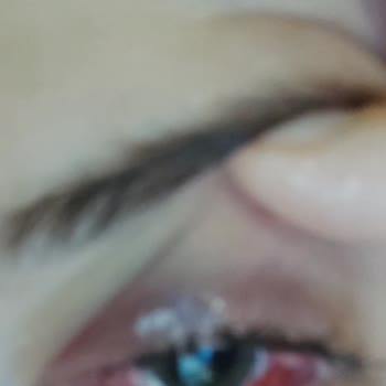 Dünya Göz Hastanesi Hastanenin Sorumsuzluğu Gözlerimi Kaybetmek Üzereyim