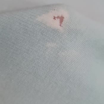 Vanish Kosla Kıyafette Lekeler Bıraktı Ve Yırtılmasına Sebep Oldu