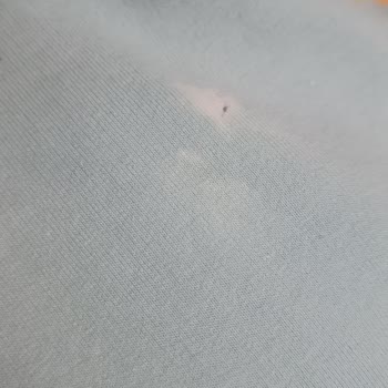 Vanish Kosla Kıyafette Lekeler Bıraktı Ve Yırtılmasına Sebep Oldu