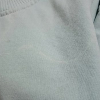 Vanish Kosla Kıyafette Lekeler Bıraktı Ve Yırtılmasına Sebep Oldu