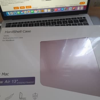 Teknosa Firmasi Yanlış Ürün Gönderdi.