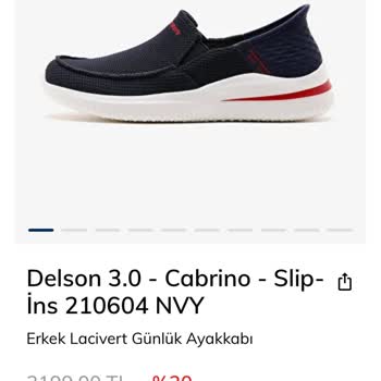 Skechers Ayakkabı Tırnak Batması!