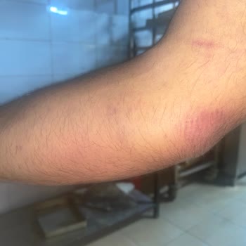 Türk Kızılay Daha Dikkatli Olunmalı