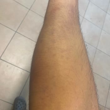 Türk Kızılay Daha Dikkatli Olunmalı