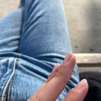 Eila Hamid Beauty Protez İşleminde Ellerimi Kanattılar, İş Bilmiyorlar!