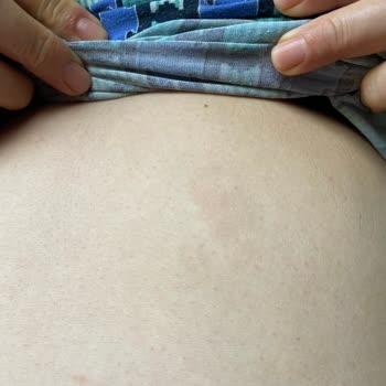 Mercy Estetik Zorla Para Alma