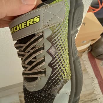 Skechers Ayakkabı 4 Ay İçinde Parçalandı. Firma Ürüne Sahip Çıkmadı