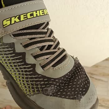 Skechers Ayakkabı 4 Ay İçinde Parçalandı. Firma Ürüne Sahip Çıkmadı