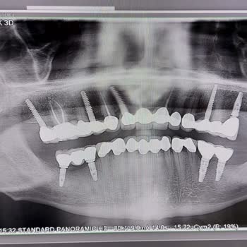 Dentanorm İnsan Sağlığından Daha Çok Önemli Olan İşte Bu 5000€