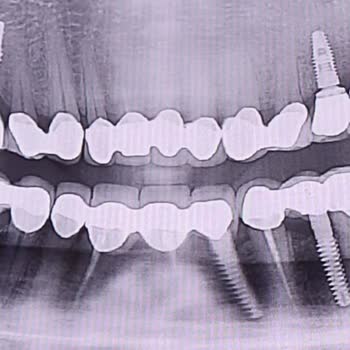 Dentanorm İnsan Sağlığından Daha Çok Önemli Olan İşte Bu 5000€