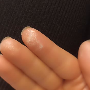 Vanish Kosla Beyazlatıcı Elimi Yaktı