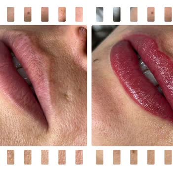 Dilan Polat Estetik Tekirdağ Şubesi Dudak Renklendirme