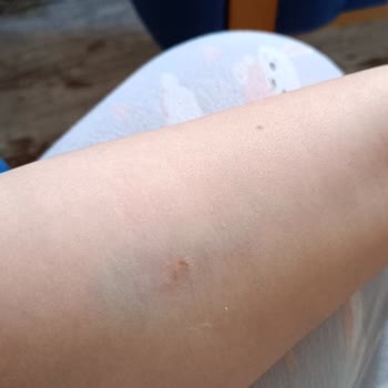 Eyüpsultan Devlet Hastanesi İşini İyi Yapmayan Hemşireler