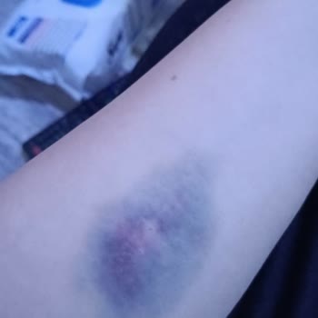 Eyüpsultan Devlet Hastanesi İşini İyi Yapmayan Hemşireler