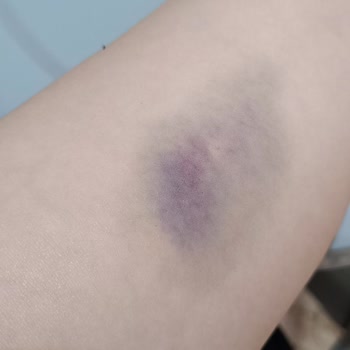 Eyüpsultan Devlet Hastanesi İşini İyi Yapmayan Hemşireler