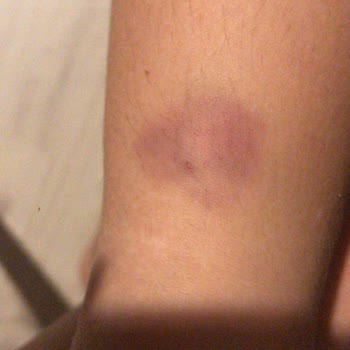 Milli Eğitim Bakanlığı (MEB) Antalya Güzeloba İöo Şiddet