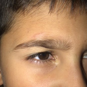 Güzeloba İlkokulu Oğlum Şiddete Maruz Kalıyor Yönetim İlgilenmiyor!