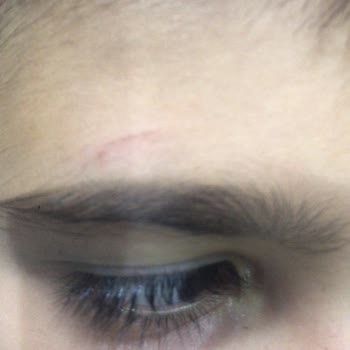 Güzeloba İlkokulu Oğlum Şiddete Maruz Kalıyor Yönetim İlgilenmiyor!