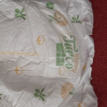 Baby Turco Bebek Bezinde Tuhaf Bir Cisim Yapışık