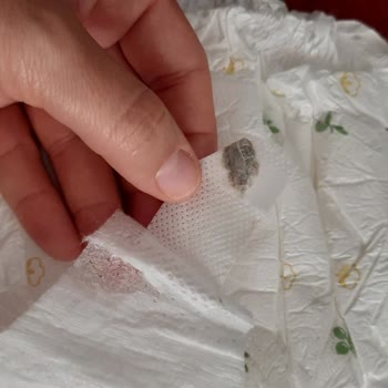 Baby Turco Bebek Bezinde Tuhaf Bir Cisim Yapışık