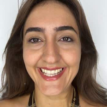 Luvimed Clinic Ataköy Şubede Botox