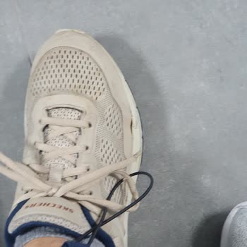Skechers Arch-Fit Yanlardan Açma Sorunu Ve Garanti Servisi