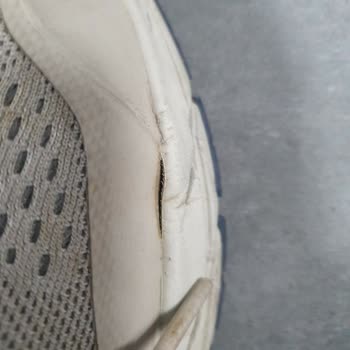Skechers Arch-Fit Yanlardan Açma Sorunu Ve Garanti Servisi
