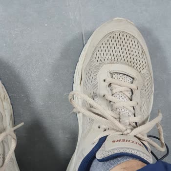 Skechers Arch-Fit Yanlardan Açma Sorunu Ve Garanti Servisi