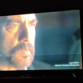 Onvo Mağduriyetimin Giderilmesi, TV 20 Gündür Arızalı