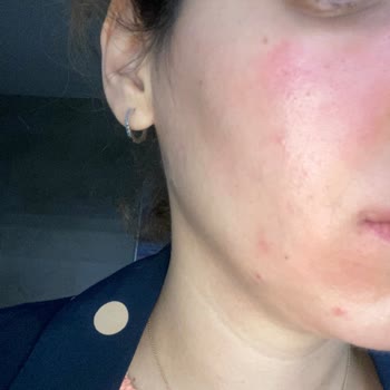 Hepsiburada Orijinalliği Şüpheli Ürünler Satıyor