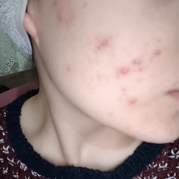 Loreal Paris L'OREAL Paris Nem Terapisi