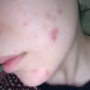 Loreal Paris L'OREAL Paris Nem Terapisi