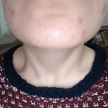 Loreal Paris L'OREAL Paris Nem Terapisi