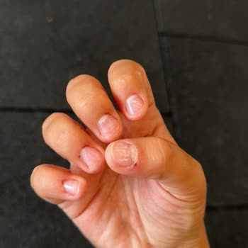 Nail House Nef22 Protez Tırnak Ve Tırnak Etlerimin Kan İçinde Kalması